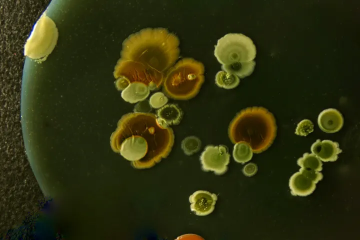 Microbiotica raises £36M Series C for precision microbiome medicines